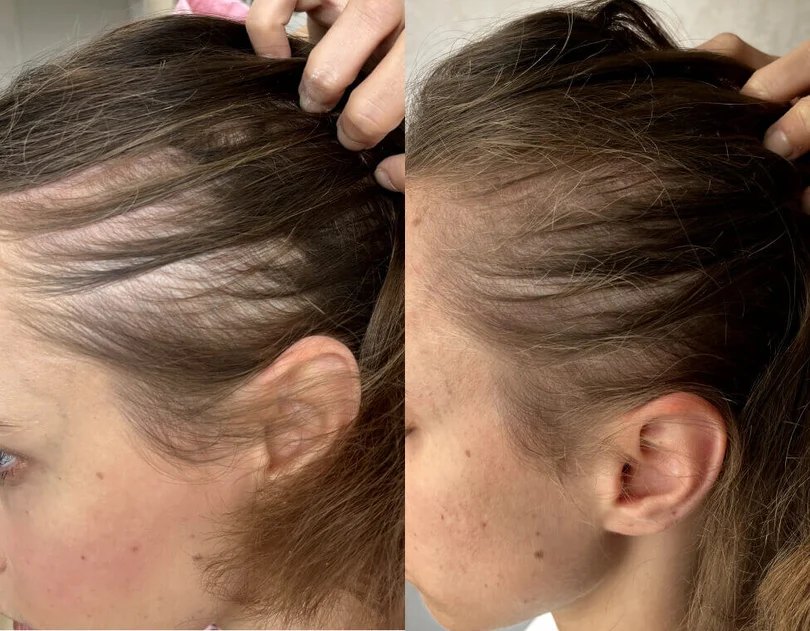 Before and after