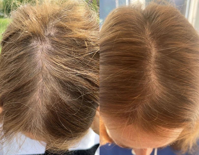 Before and after