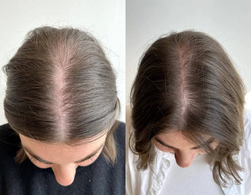 Before and after